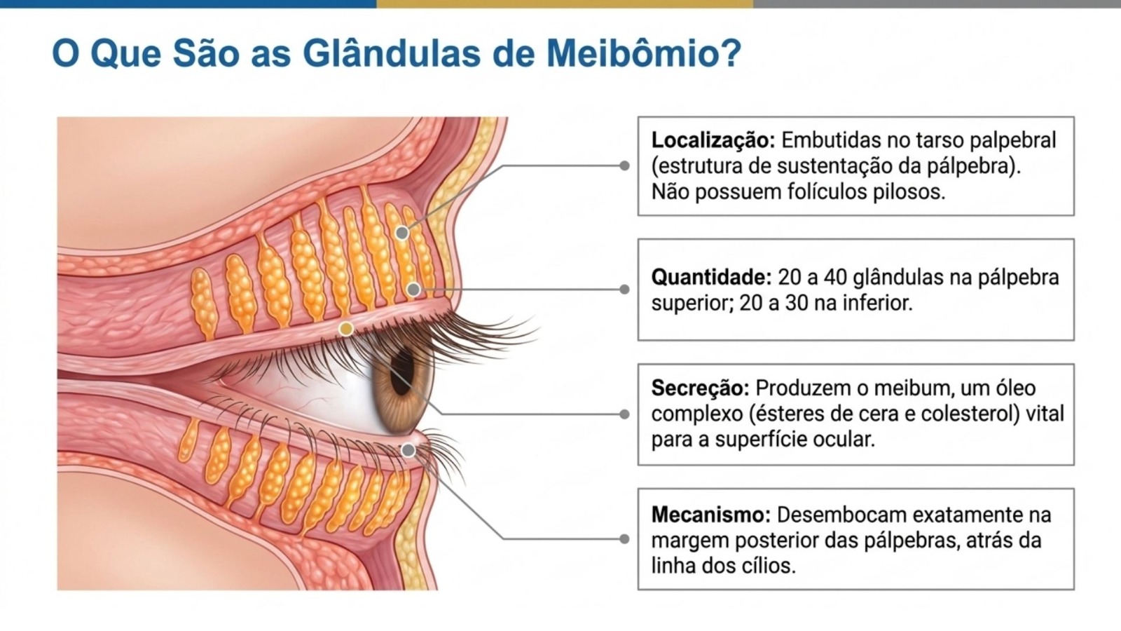 Explica&ccedil;&atilde;o ocular ilustrativa indicando localiza&ccedil;&atilde;o, quantidade, tipo de secre&ccedil;&atilde;o e mecanismo da gl&acirc;ndula de meib&ocirc;mio