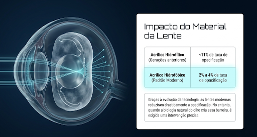 Imagem ilustrativa demonstrando o impacto que o material da lente de catarata pode causar
