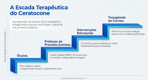 Escada terapêutica do ceratocone: Desde o uso de óculos, prosseguindo para Prótese de precisão (lentes), após para Intervenções Estruturais e por fim o Transplante, sendo o último caso.